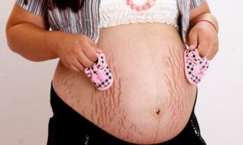 7 coisas que as mulheres não sabem sobre o corpo feminino após a gravidez