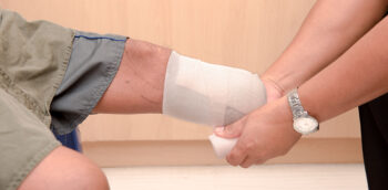 Para onde vai o membro após uma amputação? A vítima pode levar para casa?