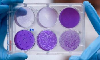 Brasil fará testes de droga que reduz 94% a carga viral do Covid-19