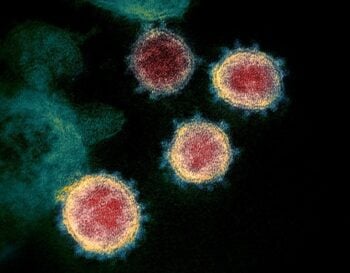 Segundo estudos, poluição pode ser o fator agravante para a grande mortalidade por Covid-19 na Itália