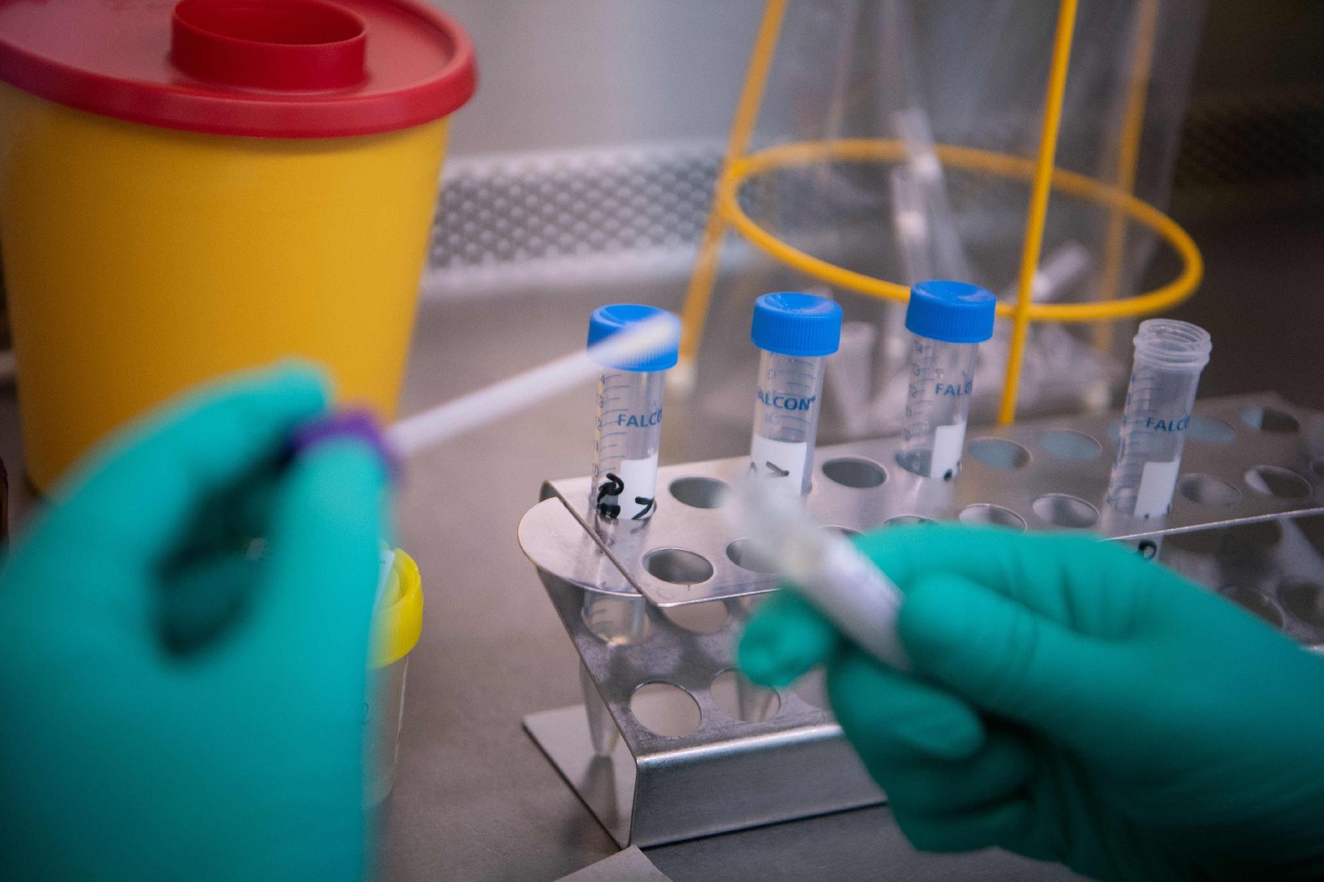 Estudo diz que o corpo humano não cria resistência a Covid-19