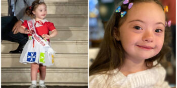 Conheça Francesca, a modelo de 4 anos que tem síndrome de down e está encantando o mundo