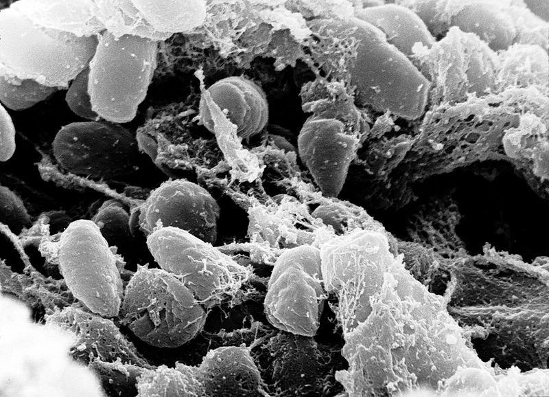 Peste bubônica pode causar nova pandemia no mundo. Veja 5 pontos que te explicarão o que é a doença