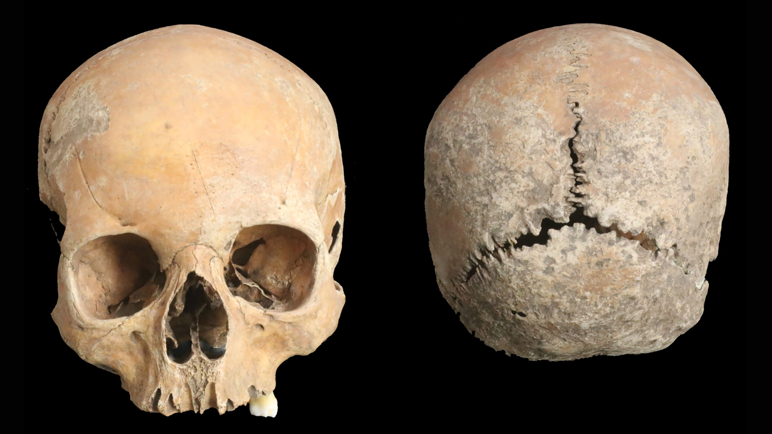 Essas eram as terríveis punições da Inglaterra Anglo-Saxã