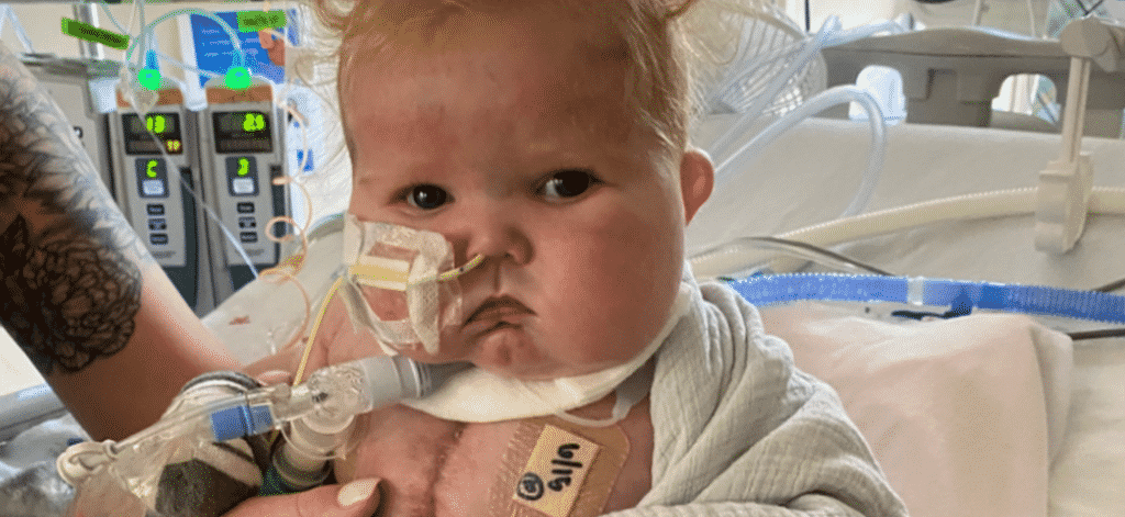 Transplante de coração e timo salvou bebê de seis meses