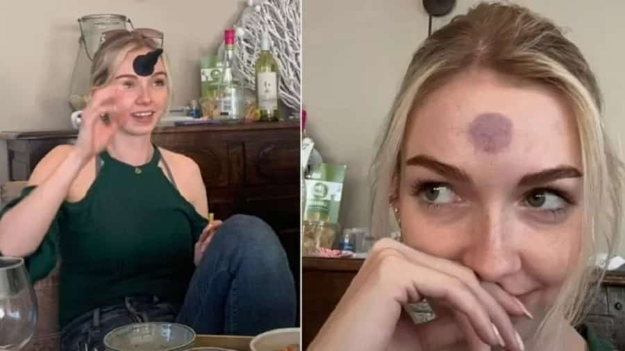 Mulher fica com roxo na testa após acidente com brinquedo erótico