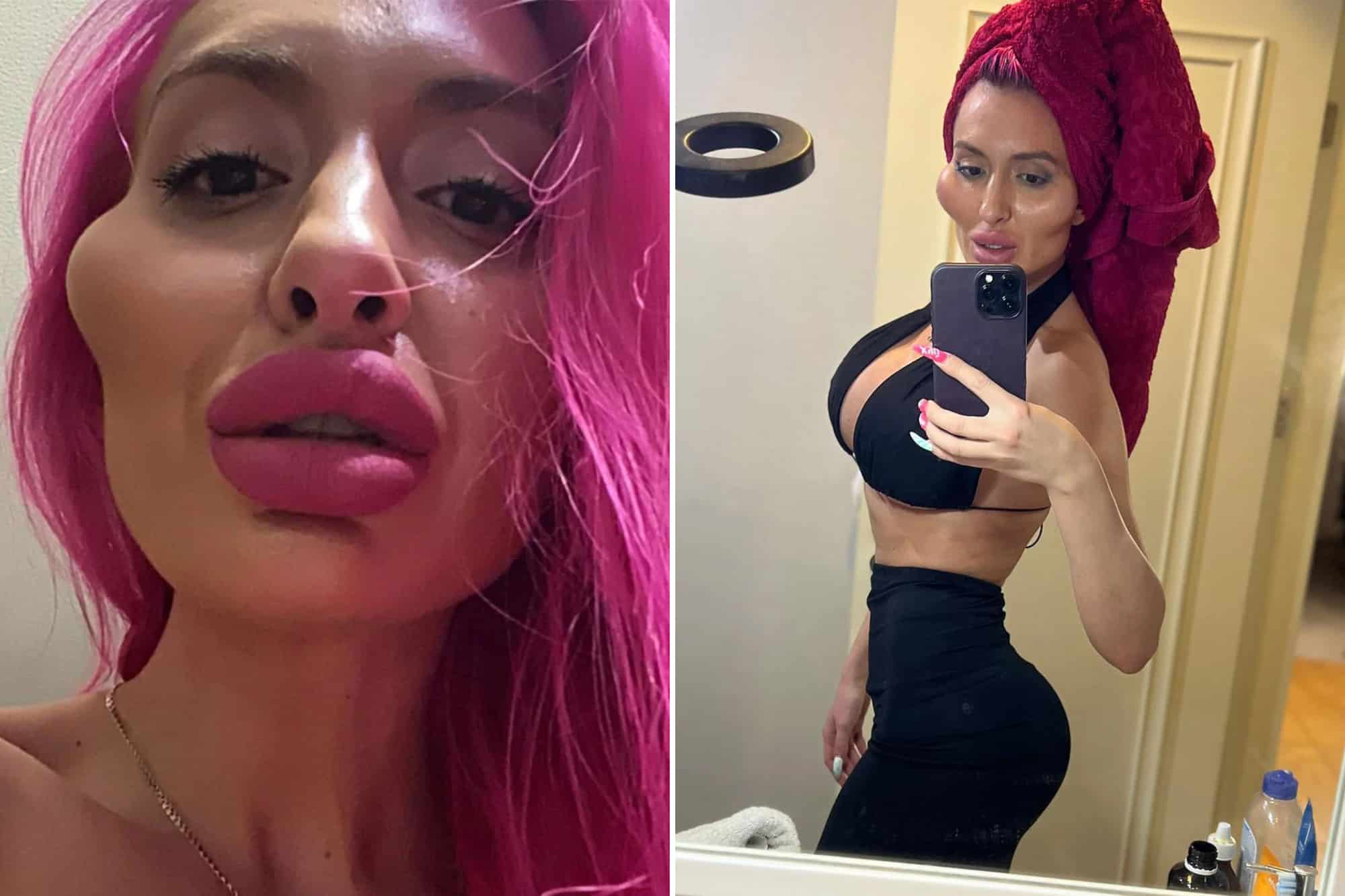 Modelo com as maiores bochechas do mundo aparece com rosto ainda maior