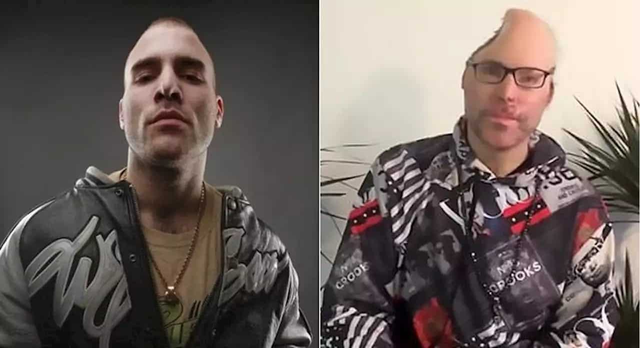 Rapper perde parte do crânio depois de explosão em laboratório
