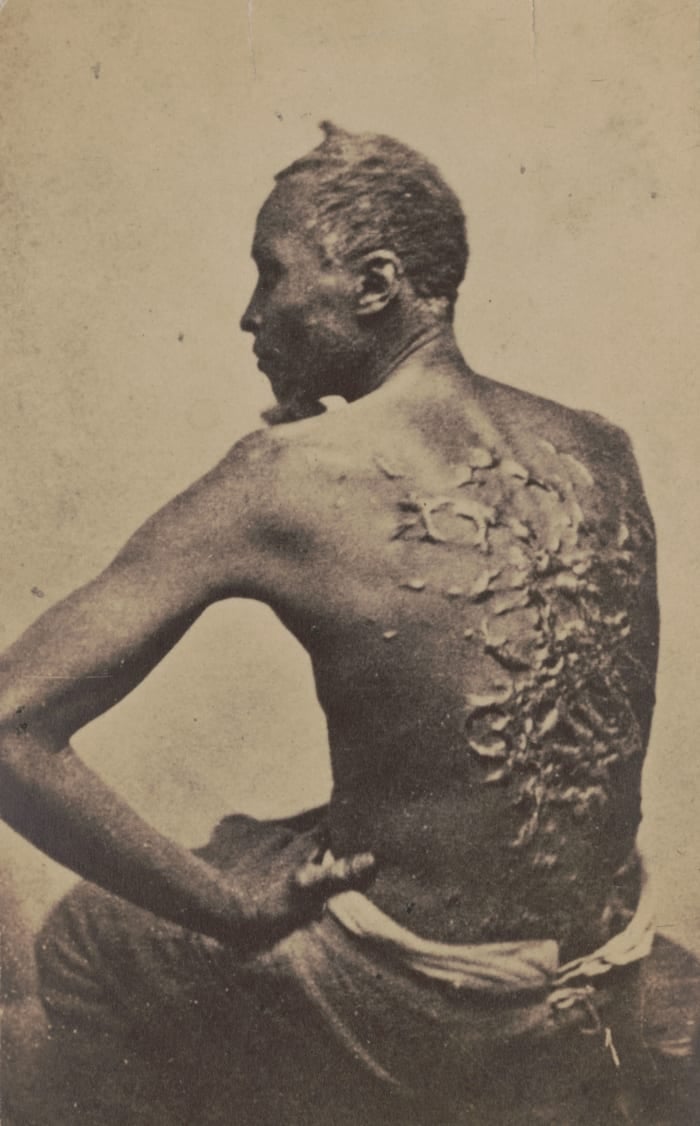 História por trás da foto que denunciou a crueldade da escravidão nos EUA