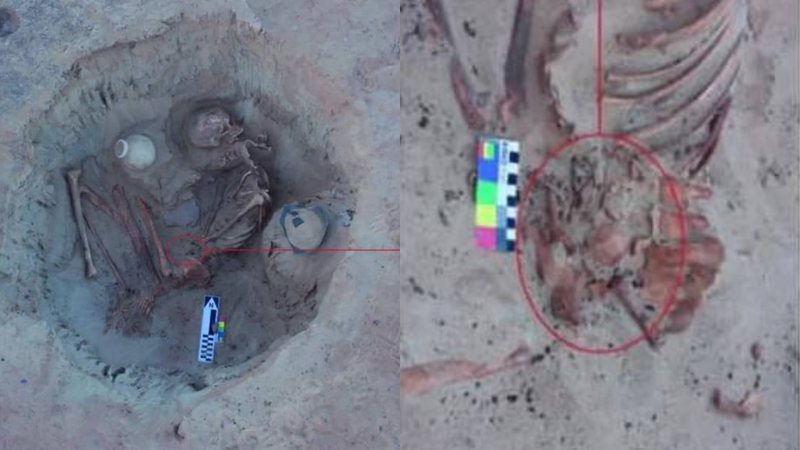 Esqueleto de 3.700 anos de mulher ainda com feto dentro do corpo é encontrado no Egito