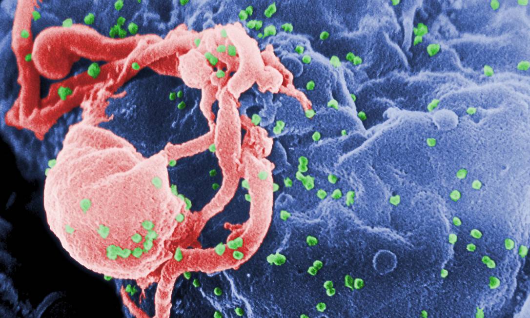 Vírus HIV pode permanecer dormente no cérebro humano, aponta estudo